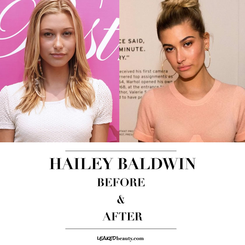 Hailey Baldwin Before & After