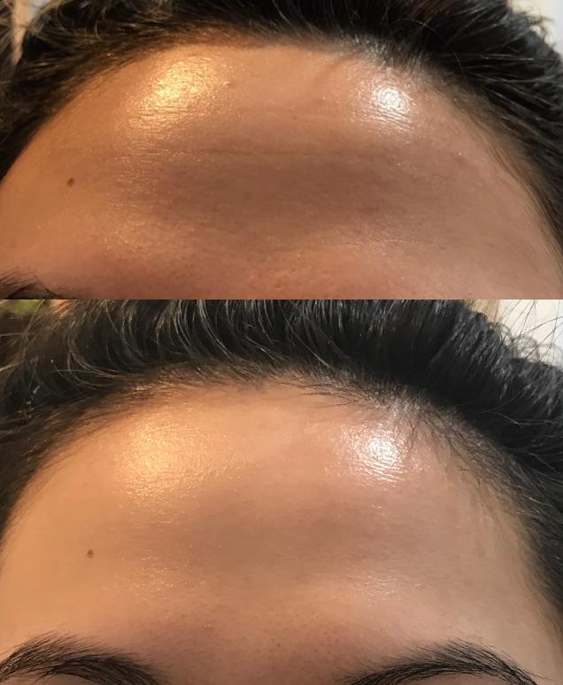 Before and After Dehydrated Skin results